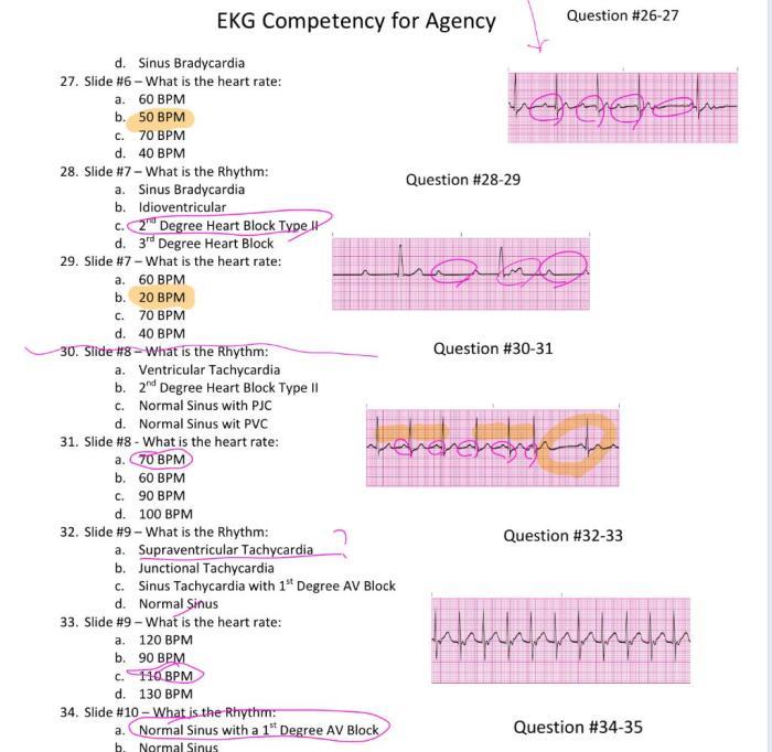 Impulse 4.0 chest pain competency series answers