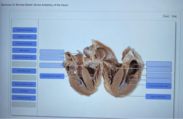 Exercise 21 review sheet gross anatomy of the heart